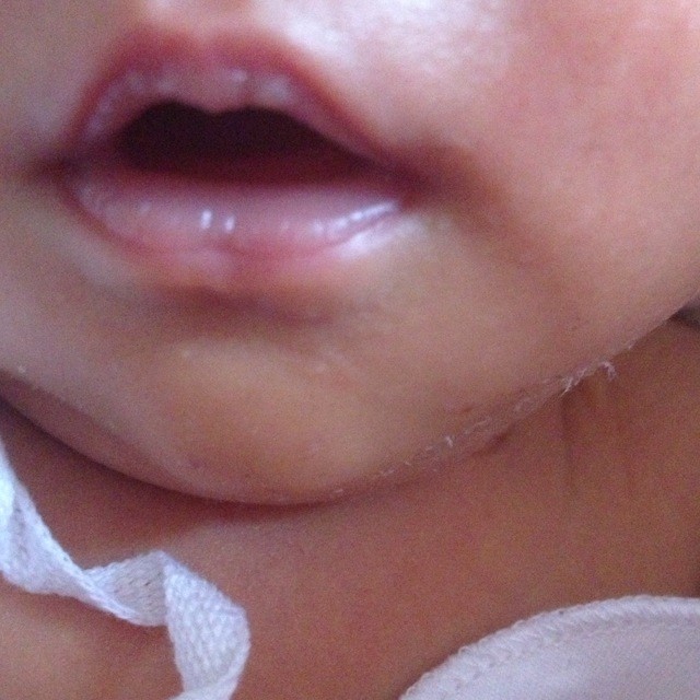 宝宝母乳 嘴巴这样怎么回事 ? 奶泡吗 还是吃的咸了