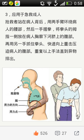 海姆立克急救法