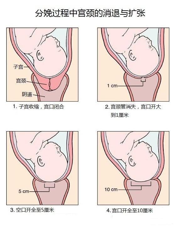 生孩子时的"开十指",是怎么回事?