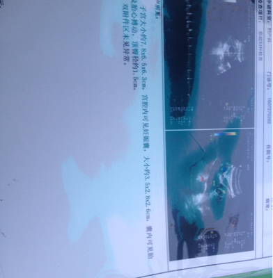 journal_insert_pic_267431478