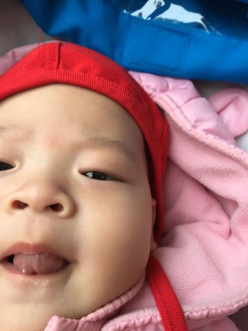 我家宝也有 发现两个月了 开始有针尖那麼大 现在有小米粒大 也是没有