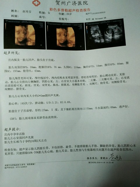 第二胎希望是男孩,有宝妈会看四维彩超的吗,能看出是男孩还是女孩吗