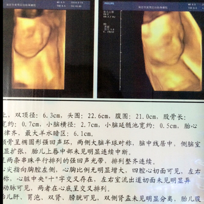 journal_insert_pic_556023029