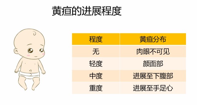 在自然光下眼睛观察,对照下面的表格,可以初步判断宝宝的黄疸