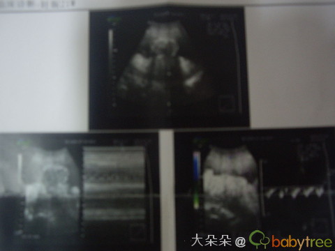 journal_insert_pic_54871106