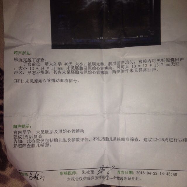 怀双胞胎40天大小