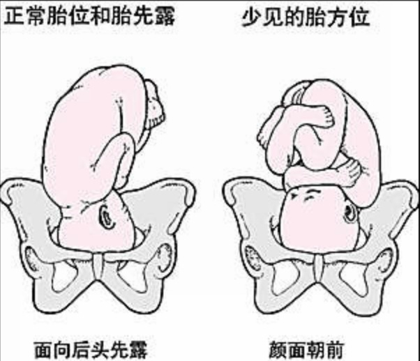 后位怕宝宝脸先出来被骨头压到,看宝宝体重了,头不要太大可能没什么