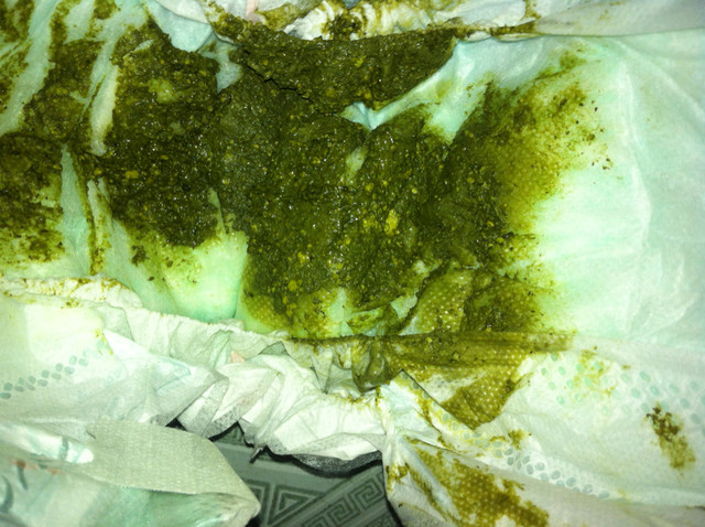 请教各位宝妈_宝宝大便这两天都是这个颜色_宝宝树