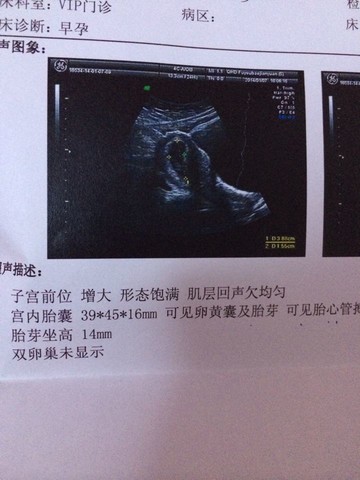 journal_insert_pic_122530939