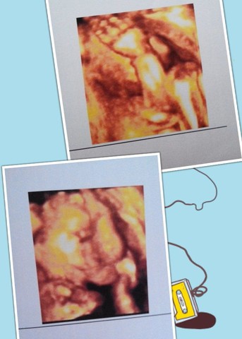journal_insert_pic_122498957