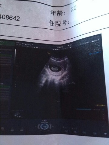 journal_insert_pic_122577426