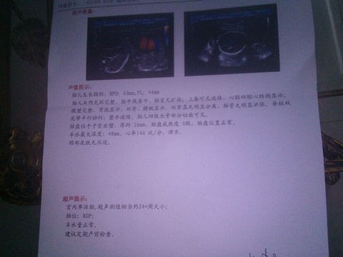 journal_insert_pic_122970663