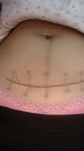 journal_insert_pic_123245667