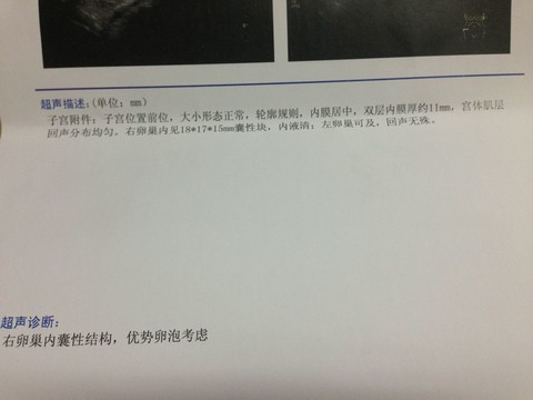 journal_insert_pic_123256538