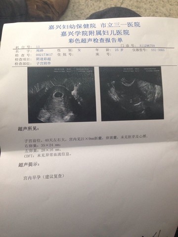 journal_insert_pic_123861869