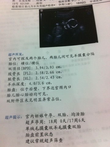 journal_insert_pic_124224421