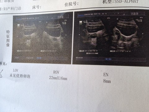 journal_insert_pic_124515121