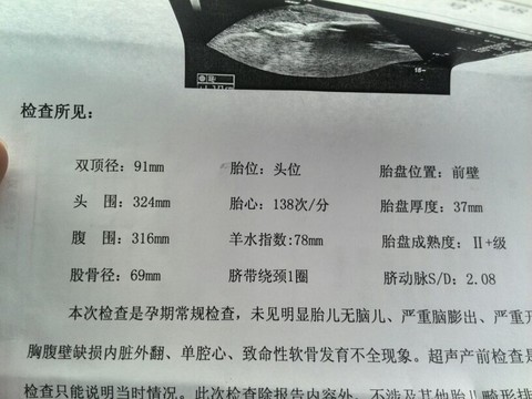 journal_insert_pic_124675345