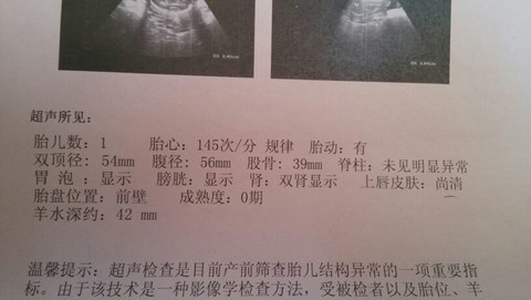 journal_insert_pic_124796382