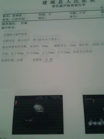 journal_insert_pic_124793844
