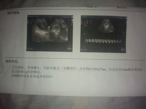 journal_insert_pic_127720888