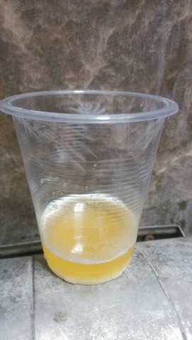 小苏打加尿是这样的,怎麼算啊