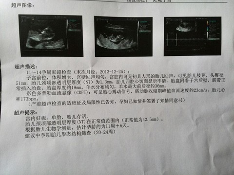 journal_insert_pic_129050828