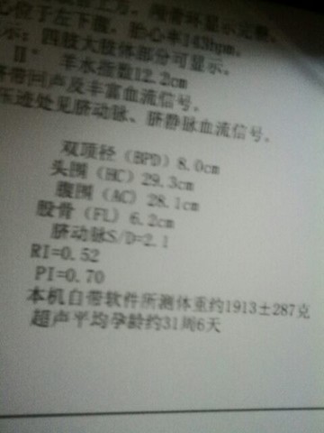 journal_insert_pic_129436494