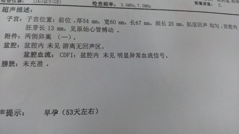 journal_insert_pic_129468020