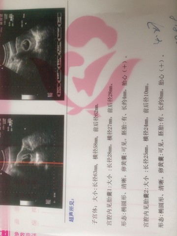 journal_insert_pic_129608599