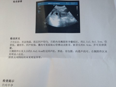 journal_insert_pic_129882162