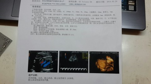journal_insert_pic_130172852