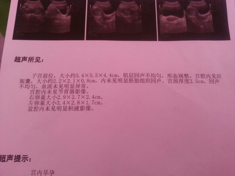 journal_insert_pic_130127620