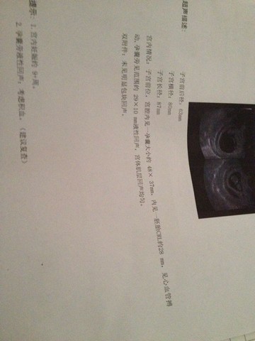 journal_insert_pic_130391186