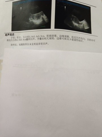 journal_insert_pic_131292497