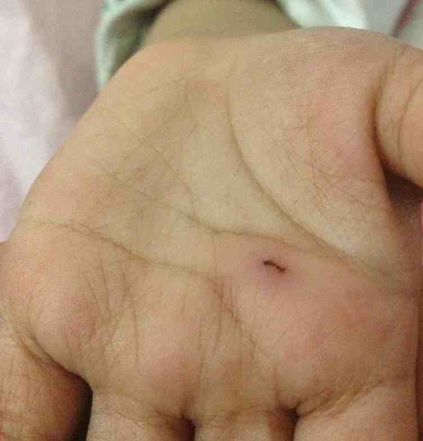 圈子 2012年12月 20楼 那去割积感觉很痛啊…好可怜啊…其它法子也试