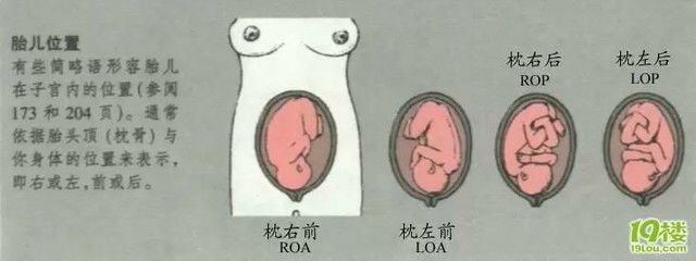 胎位图LOT图片