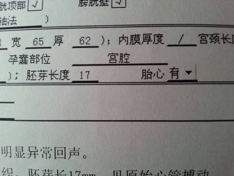 journal_insert_pic_134340739