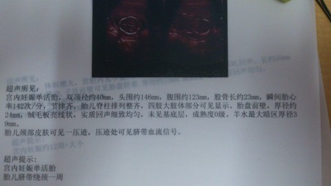 journal_insert_pic_134539641