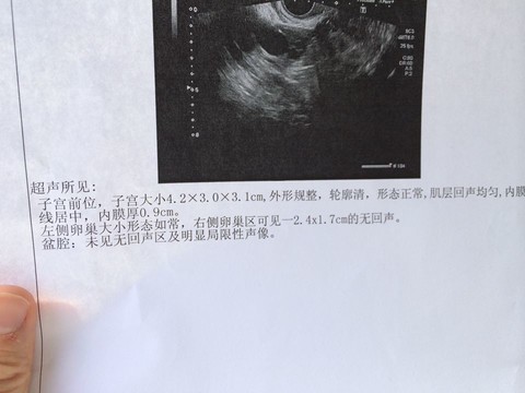 journal_insert_pic_135910880