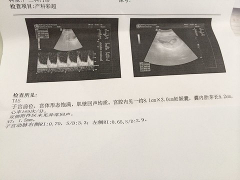 journal_insert_pic_136499242