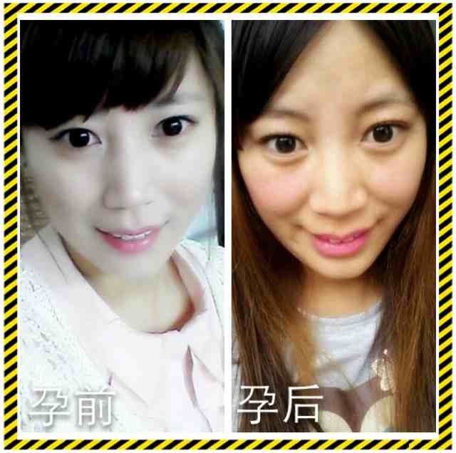 孕前孕后差别