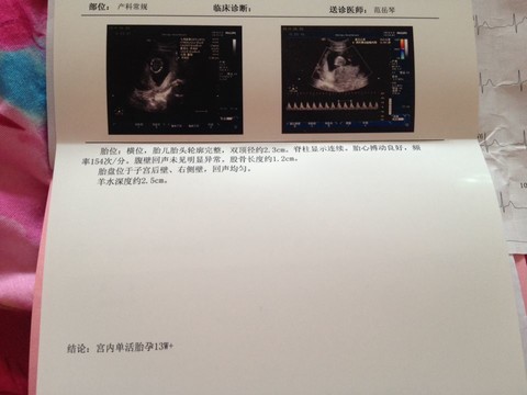 journal_insert_pic_139813442