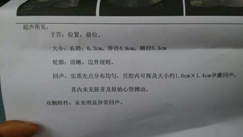 journal_insert_pic_141596817