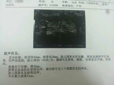 journal_insert_pic_142967278