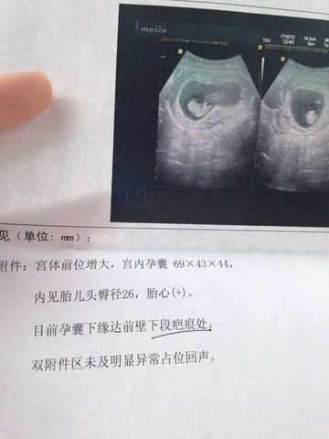 journal_insert_pic_143678960