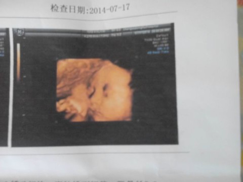 journal_insert_pic_145016227