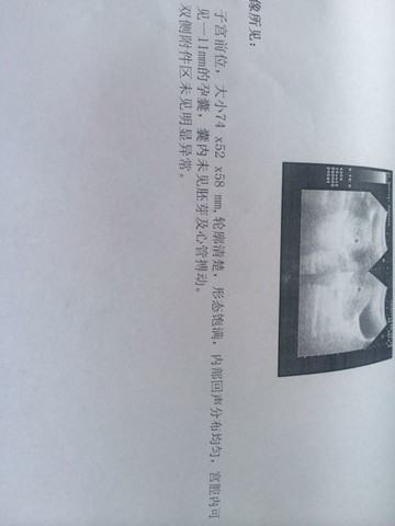 journal_insert_pic_145219425