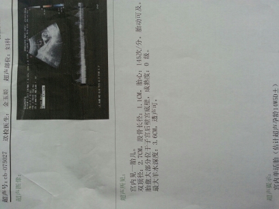 journal_insert_pic_145242641