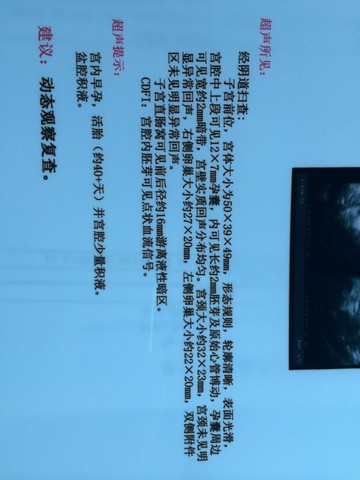 journal_insert_pic_145372431